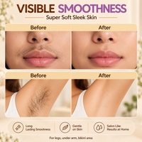 MicroWax - Roll On Hair Removal